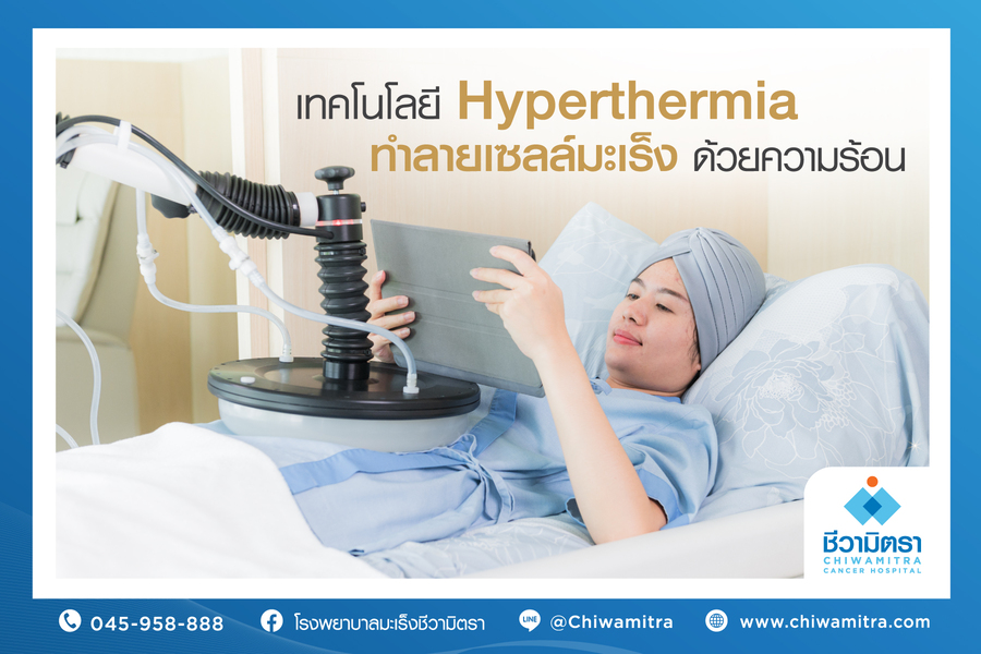 เทคโนโลยี Hyperthermia ทำลายเซลล์มะเร็งด้วยความร้อน