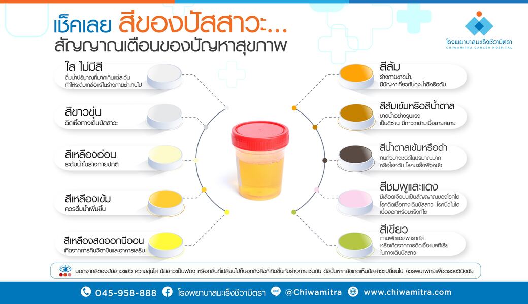 สีของปัสสาวะ…สัญญาณเตือนของปัญหาสุขภาพ