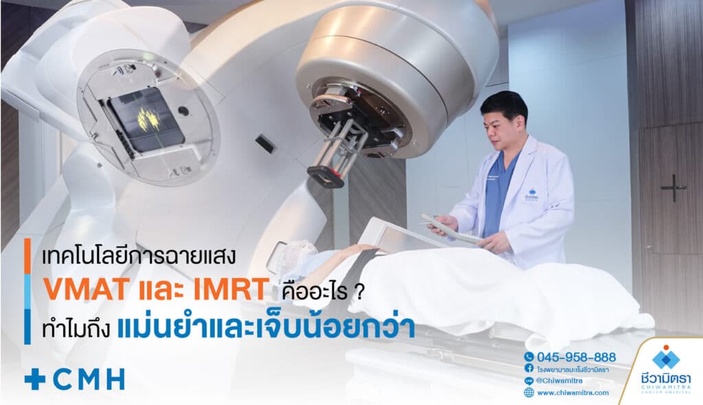 เทคโนโลยีการฉายแสง VMAT และ IMRT คืออะไร? ทำไมถึงแม่นยำและเจ็บตัวน้อยกว่า